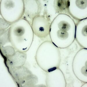 MA003 - Mitosis, Ascaris - Round Worm